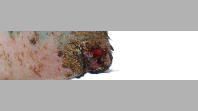 Ear necrosis: Ulceration, crust formation and thickening of the epidermis