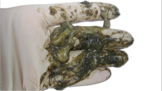 Catarrhal diarrhea
