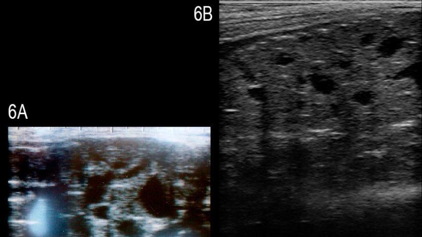 Fig. 6: Images of the bulbourethral gland of the affected boar having multiple well-defined anechogenic cysts of different size (A) and of a healthy boar for comparison (B) (from Grahofer et al., 2016).
