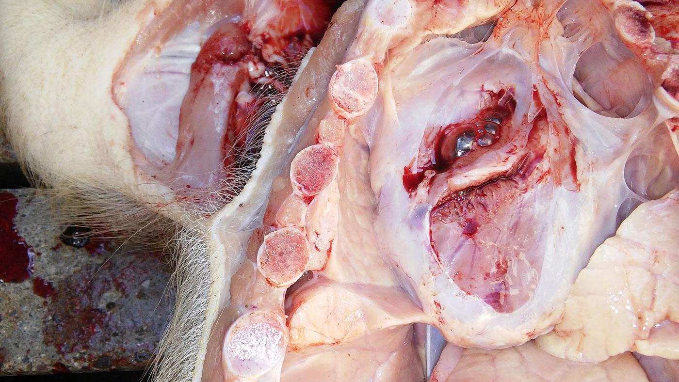 Figure 5. Pericarditis.
