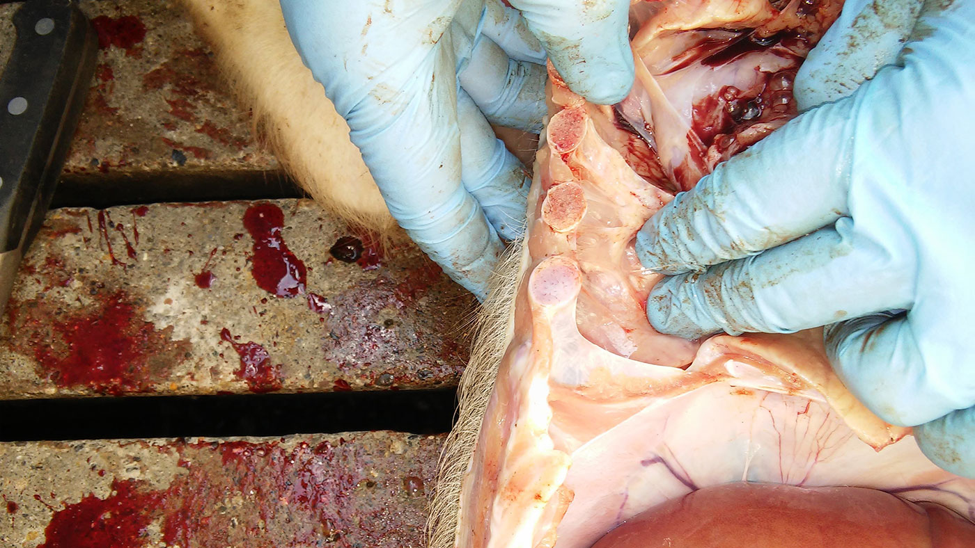 Figure 6. Pleurisy between the lung pleura and the rib cage pleura.

