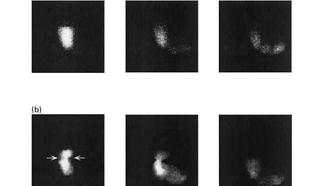 Figure 1. Images of gastric emptying in pigs fed a diet based on starch (a), beet pulp (b) and wheat bran at 10, 60 and 120 minutes post-ingestion (Source: Guerin et al., 2001 ).
