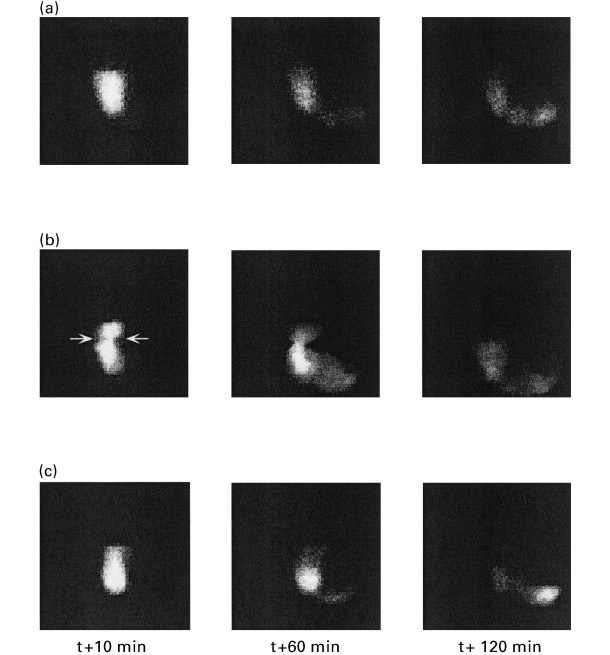 <p>Figure 1. Images of gastric emptying in pigs fed a diet based on starch (a), beet pulp (b) and wheat bran at 10, 60 and 120 minutes post-ingestion (Source: Guerin et al., 2001 ).</p>
