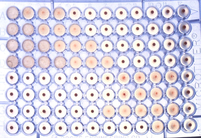 Figure 3: Haemoagglutination test for detection of anti-Brucella antibodies in serum.
