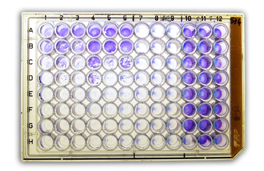 Serum virus neutralization