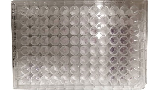 Example of the measurement of PRRSV-specific interferon gamma (IFN-γ) secreting cells by enzyme-linked immunospot (ELISPOT) assay using a 96-well plate.