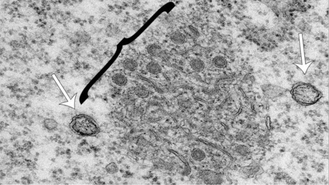 Electron micrograph of the two replication organelle structures. White arrows indicate double membrane vesicles and the black bracket encompasses the small circular spherules which protrude from the zippered endoplasmic reticulum (ER) that appear as tubular shapes.