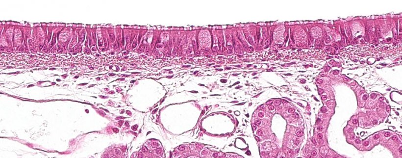 Figure&nbsp;1: Ciliated pseudostratified epithelium with goblet cells,&nbsp;characteristic of the respiratory system.
