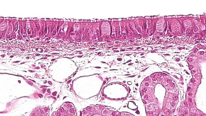 Figure&nbsp;1: Ciliated pseudostratified epithelium with goblet cells,&nbsp;characteristic of the respiratory system.
