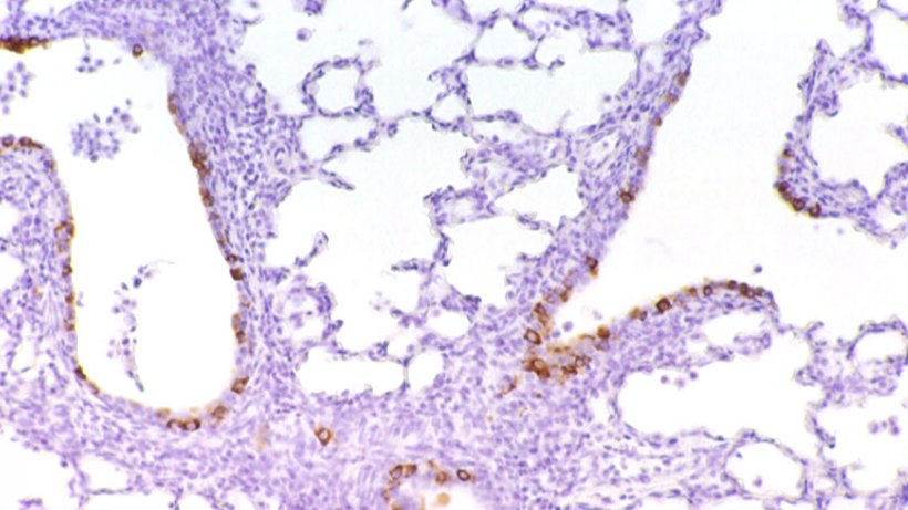 Figure 6: Cells immunolabelled for PRCV in the bronchial epithelium
