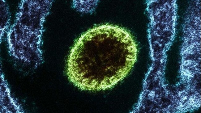Colourised transmission electron micrograph of a Nipah Virus particle (green) near the edge of an infected cell (blue). Image captured and colour-enhanced at the NIAID Integrated Research Facility in Fort Detrick, Maryland. Credit: NIAID