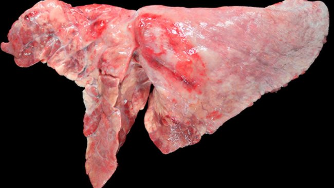 Figure 5: Pig lung co-infected with M. hyopneumoniae and A. pleuropneumoniae. Cranioventral areas of consolidation with a reddish-brown color, caused by infection by M. hyopneumoniae, and an oval-shaped lesion with pleural fibrosis and hemorrhagic area in the diaphragmatic lobe, which would correspond to the chronical stage after an outbreak of necrosis caused by A. pleuropneumoniae.