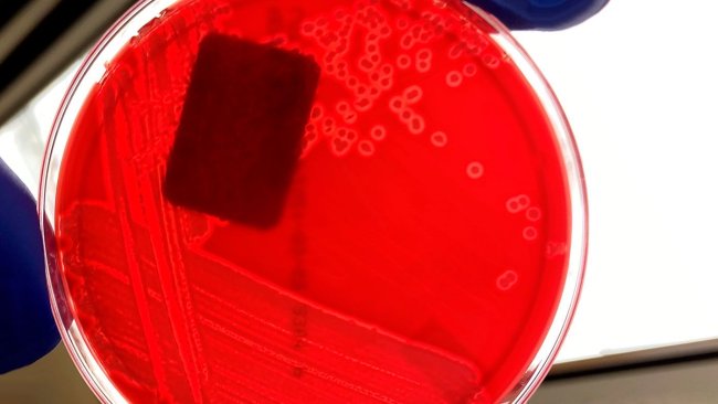Figure 1. Pure culture of haemolytic E. coli on a blood agar plate. Note the clear zone around each bacterial colony indicating hemolysis (breaking down of blood in plate agar). Photo Credits: Iowa State University, Veterinary Diagnostic Laboratory, Bacteriology Section