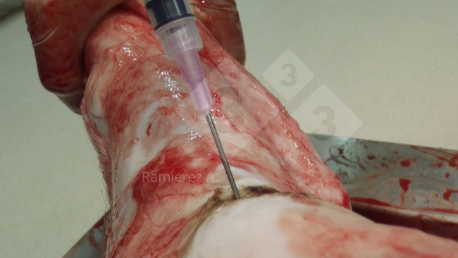 Figure 1. Sampling of the joint fluid from a dead pig. Skin is removed and a syringe is used to collect joint fluid aseptically.
