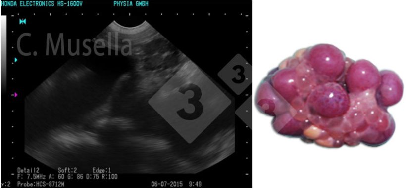 Figure 1. Corpora lutea.
