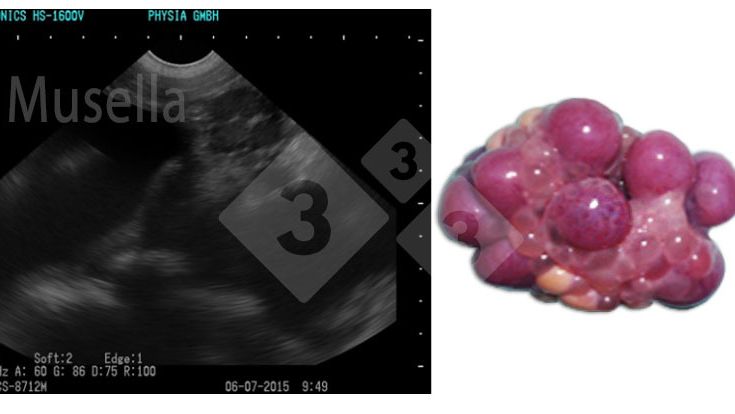Figure 1. Corpora lutea.
