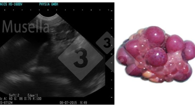 Figure 1. Corpora lutea.