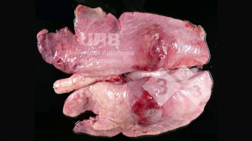 Figure 1. Fibrinous-necrotizing pleuropneumonia compatible with App. Source: UAB.
