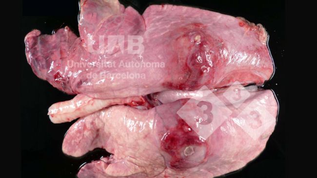 Figure 1. Fibrinous-necrotizing pleuropneumonia compatible with App. Source: UAB.
