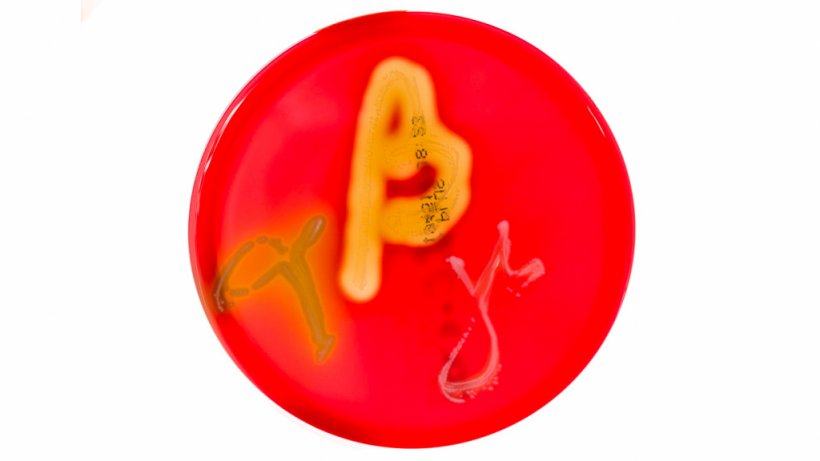 Figure 1. Petri dishes cultures on blood agar demonstrating alpha, beta, and gamma hemolysis. Source:&nbsp;Mibilehr https://creativecommons.org/licenses/by-sa/4.0/deed.ene&nbsp;
