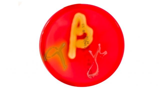 Figure 1. Petri dishes cultures on blood agar demonstrating alpha, beta, and gamma hemolysis. Source: Mibilehr https://creativecommons.org/licenses/by-sa/4.0/deed.ene 