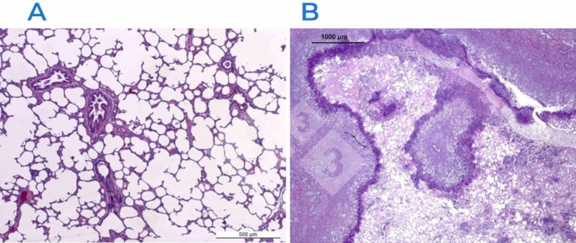 Figure 2. Haematoxylin and eosin stain in a normal (A) and damaged (B) lung. The lung in B is affected by a fibrino-necrotizing pleuropneumoniae caused by Actinobacillus pleuropneumoniae.
