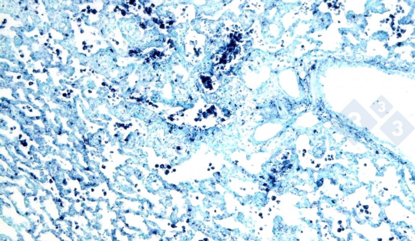 Figure 4. In situ hybridization to detect porcine circovirus 2 (PCV-2) in a lung affected by interstitial pneumonia.
