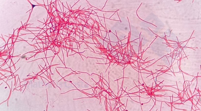 Figure 2.&nbsp;Fusobacterium necrophorum under the microscope.
