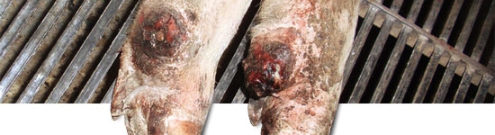 Detachment of the auxiliary digit