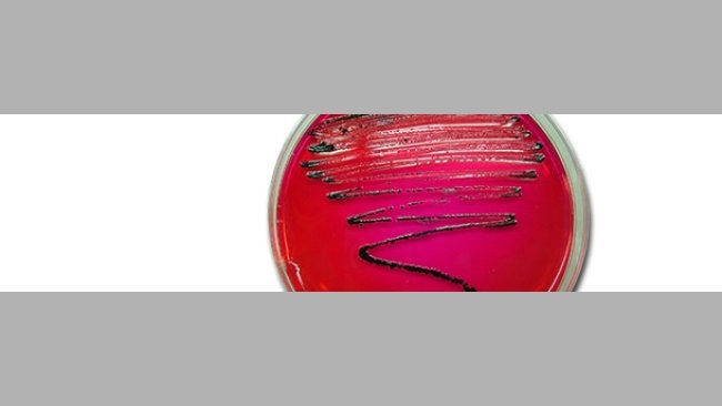 Isolation of Salmonella in XLD. In this culture medium the Salmonella colonies grow with a black colour due to the production of hydrogen sulphide