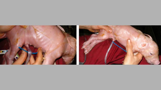 Tying the navel cords with tie wraps