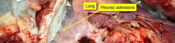 Pericarditis