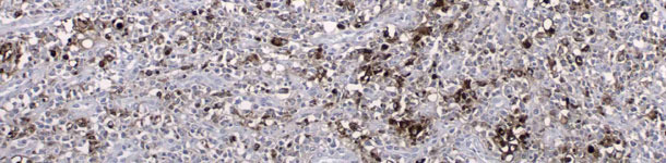 PCV2 antigen detected by an immunohistochemistry technique