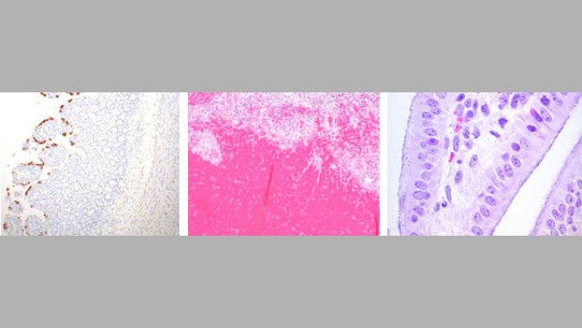Rotavirus, E.coli and Clostridium perfringens