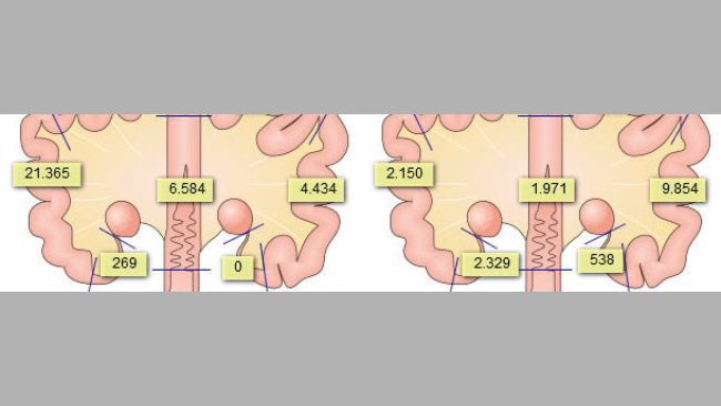 Presence of sperm cells in the genital tract of sows after 2 inseminations