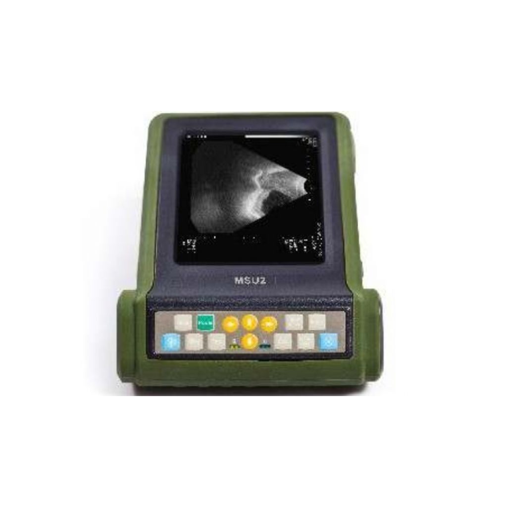 Kaixin MSU2 3.5 MHz Ultrasound Scanner